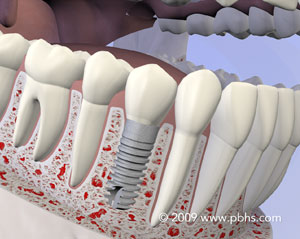 Igor Tikhonov DDS, MD,
Oral Surgeon,
Wisdom Teeth,
Bone grafting,
Dental implants,
Oral Surgeon Dallas,
Oral Surgeon Coppell,
Oral Surgeon Near Me,
Igor Tikhonov,
Igor Tikhonov Oral Surgeon, Irving Oral Surgery, Flower Mound Oral Surgery, Cross Roads Oral Surgery, Valley Ranch Oral Surgery, Lewisville Oral Surgery, Denton Oral Surgery, Southlake Oral Surgery, Grapevine Oral surgery, Farmers Branch Oral Surgery, Dental Implants, Sedation, cheap wisdom teeth extraction